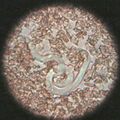 Microfilaria