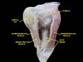 Medial rectus muscle