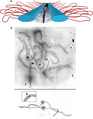 Synaptonemal complex
