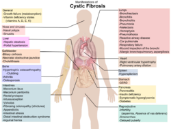 Manifestations of cystic fibrosis