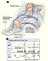 Sleep studies