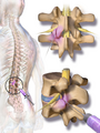 Facet joint injection