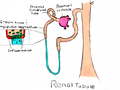 Renal tubules affected by exertional rhabdomyolysis