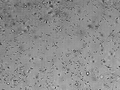 Sperms (urine) - Spermler (idrar)