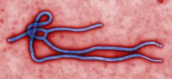 Ebola virus virions