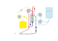 Continuous Venovenous Hemodiafiltration (CVVHDF)