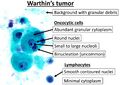 Cytopathology of Warthin's tumor
