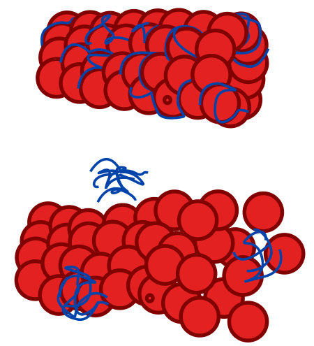 Tauopathy