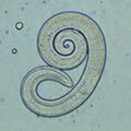 Trichinella larva under microscope