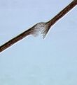 Tricho-hepato-enteric syndrome