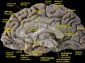 Cingulate cortex