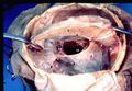 Human brain dura mater reflections