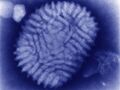 Myxoma virus (transmission electron microscope)