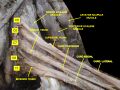 Posterior cord of the brachial plexus
