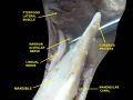 Coronoid process of the mandible