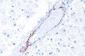 CADASIL - very high magnification