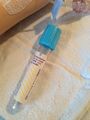 Blue top tube used for coagulation tests