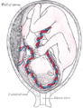 Percutaneous umbilical cord blood sampling