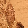 Schistosoma intercalatum egg