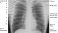 Chest labeled