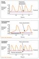 Depolarization in sinus rhythm