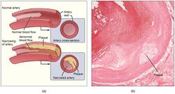 Illustration from Anatomy & Physiology, Connexions