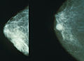 Projectional_radiography