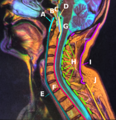 Anatomy of the neck sagittal color MRI