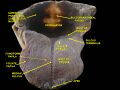 Another microscopic view of lingual papillae.
