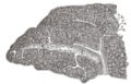 Gray's Anatomy illustration of the pancreas and duodenum
