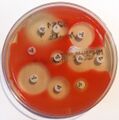 Serratia marcescens antibiogram