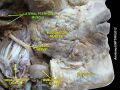 Sublingual_gland