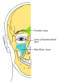 Diagram of the frontal sinus anatomy