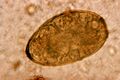 Paragonimus westermani egg